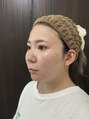 ツルんです。研究所 ウイ(Ui) お肌オタクになってここまでお肌が変わりました。