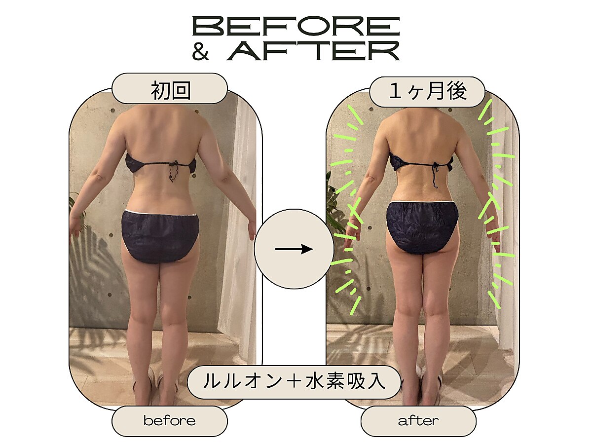 高円寺駅で毛穴ケアが人気のエステサロン｜ホットペッパービューティー