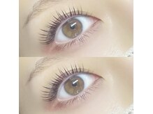 ビオエル(BIOEL)/