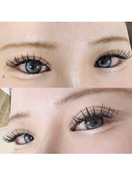 ユーアンドワイ(Yu&Y)/バインドロック