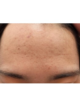 お肌をきれいにしたい