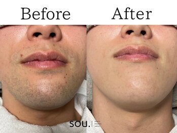 ソウ 津幡店(sou.)/