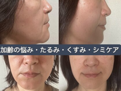 エメ 心斎橋(Aimer)の写真