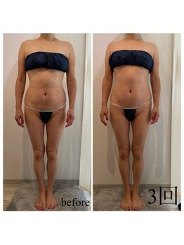 ドリームローズ(Dream Rose)/痩身