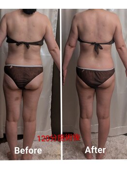 フィニシオン/60代120施術