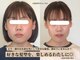 小顔専門サロン914の写真