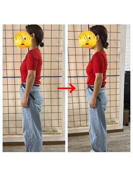 カイロプラクティック 楓/産後　骨盤調整