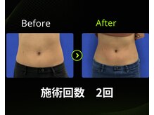 キートス(Kiitos)の雰囲気（お悩み改善実感☆痩身/オンダシェイプ/浮き輪肉撃退/お腹/二の腕）