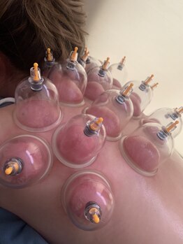 ベリーベリー 九条店(VERY-VERY)/カッピングもできます