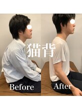 整骨院 整体院 ユールーム 周南支店(YOUROOM)/【猫背】