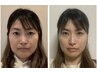 [小顔/たるみ改善]高技術◎オールハンド小顔矯正　
