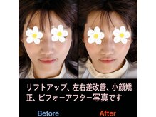 美容矯正サロン レレポノ(LELEPONO)/