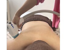 全身脱毛（顔・VIO込）で初回￥９,800！