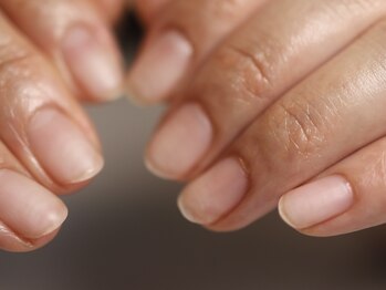 クロ(KURO)/自爪育成/柳津ネイルサロン