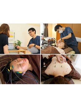 鍼灸施術を受けたい