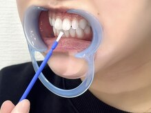 ホワイトニングバー 心斎橋オーパ店/歯の表面にジェルを塗る
