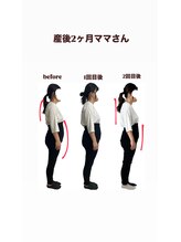 ブルーノ(Bruno)/骨格矯正ビフォーアフター