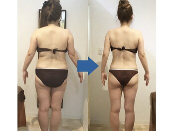 ピュアトゥルー 岐阜西店(PureTrue)/余分なお肉に高周波！ラジオ派！