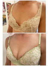 美人バスト 豊橋店/バストアップ症例【バストケア】