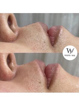 ホワイトワックス 京都四条烏丸(WHITE WAX)/意外と見られている口元 WAX