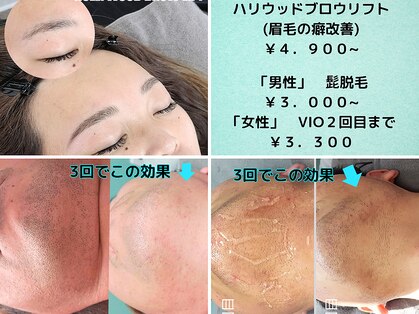 エイプリルプラス(April plus)の写真