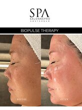 スキンラウンジ(SKIN LOUNGE)/欧州発！バイオパルスセラピー