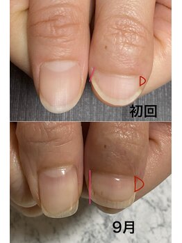 サンマルイチ(301)/ビフォーアフター