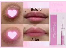 40%オフ&アフタークリームプレゼントキャンペーン中！