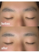 リノア(Linoa)/メンズ眉毛デザイン脱毛