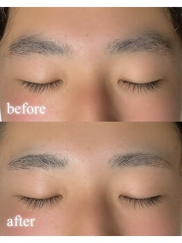 リノア(Linoa)/メンズ眉毛デザイン脱毛