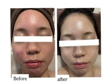 リア(Li’a)の雰囲気（お肌に合わせて最適なメニューをご提案します。）