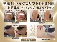 グレイスボディ BiViつくば店(Grace Body)