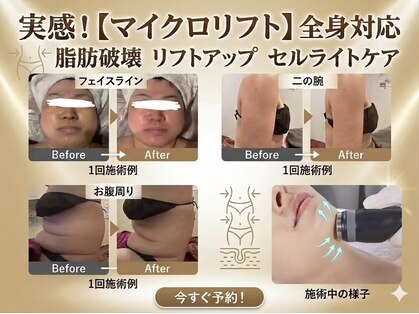 グレイスボディ BiViつくば店(Grace Body)の写真