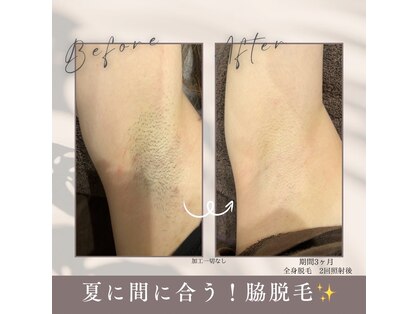 モアトゥインクル 福山宮通り店(MORE twinkle)の写真