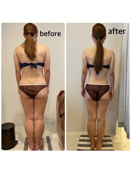 ローズハニー 小田原店/痩身モニター様比較写真