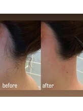 ビューティーサロンレモン(Lemon)/うなじWAX