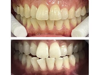 レイジースワン/プレミアム初回¥8,800