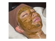 メンテ(MENTE)/大人気ハーブピーリング