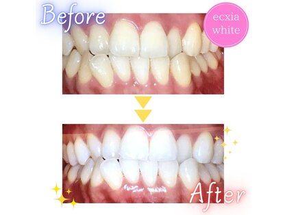 エクシアホワイトニング 都城店の写真