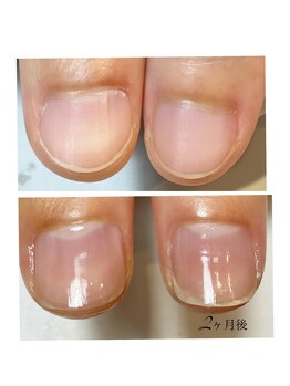 ミリアネイル 成城(Miliea nail)/
