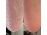 【フット】フットバス付つるつるかかとケア☆足裏角質除去で足裏美人に！！