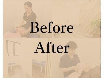 イコット(icotto)/整体・エステのビフォーアフター