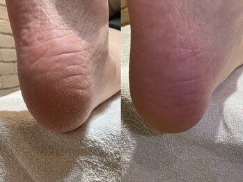 コフレ 千歳烏山(Coffret)/foot care