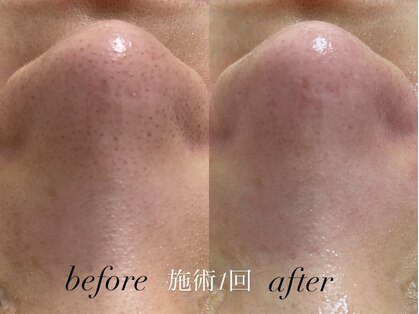 リスポアラボ(LIS PORE.LAB)の写真