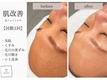サロン ド パーフェクション(Salon de Perfection)/ブラックピール
