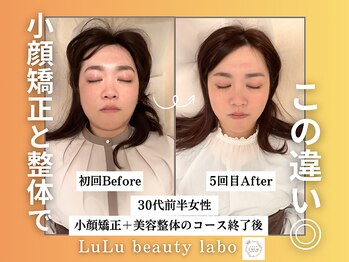 ルルラボ(LuLu beauty labo)の写真/【小顔矯正&頚椎整￥3,900】食いしばり/エラ張りを根本改善☆