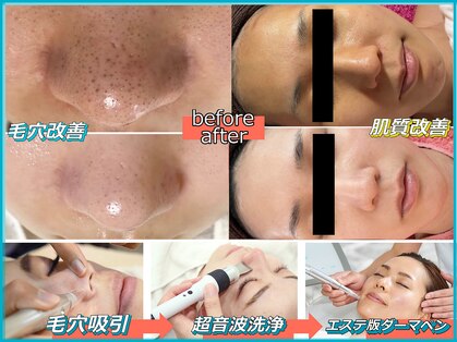 パルテールの写真