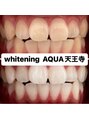 アクア 天王寺店(AQUA)&nbsp;セルフホワイトニング/大阪/天王寺/小顔/ホワイトニング/美白