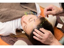 北梅田美容鍼灸院/【大阪/梅田】美容鍼灸