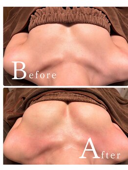 ロココ 水戸店(Rococo)/バストアップBefore After